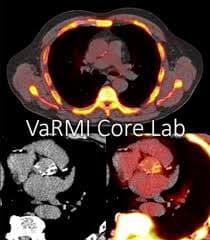 VaRMI Core Lab